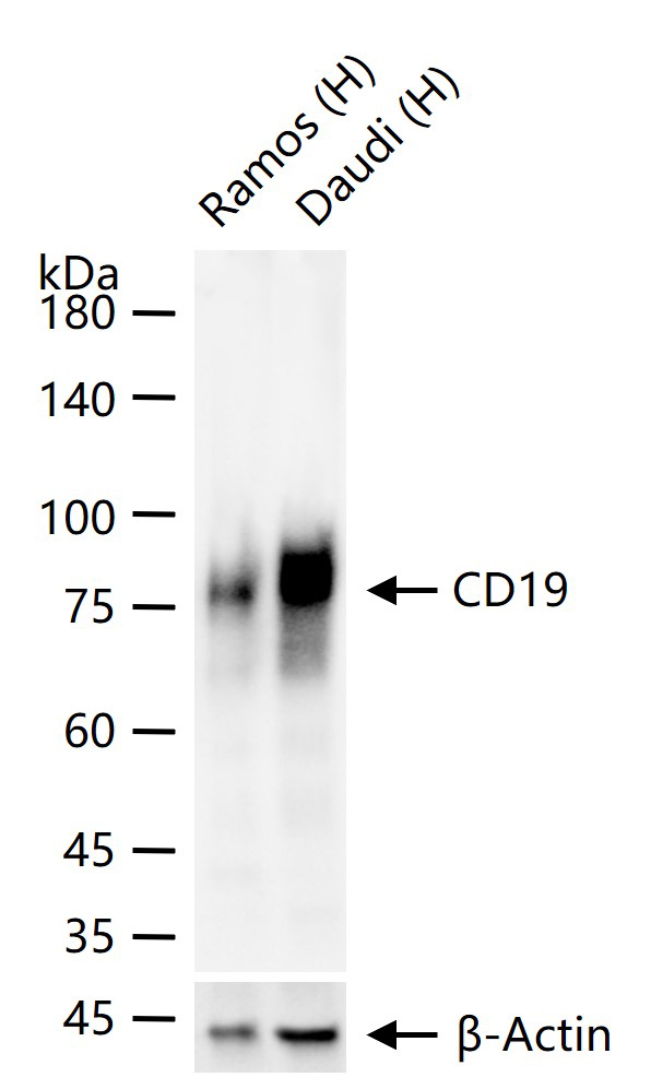 CD19重组兔单抗