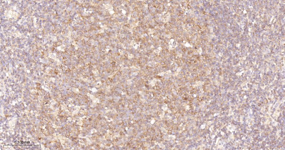 转录因子RelB蛋白重组兔单抗