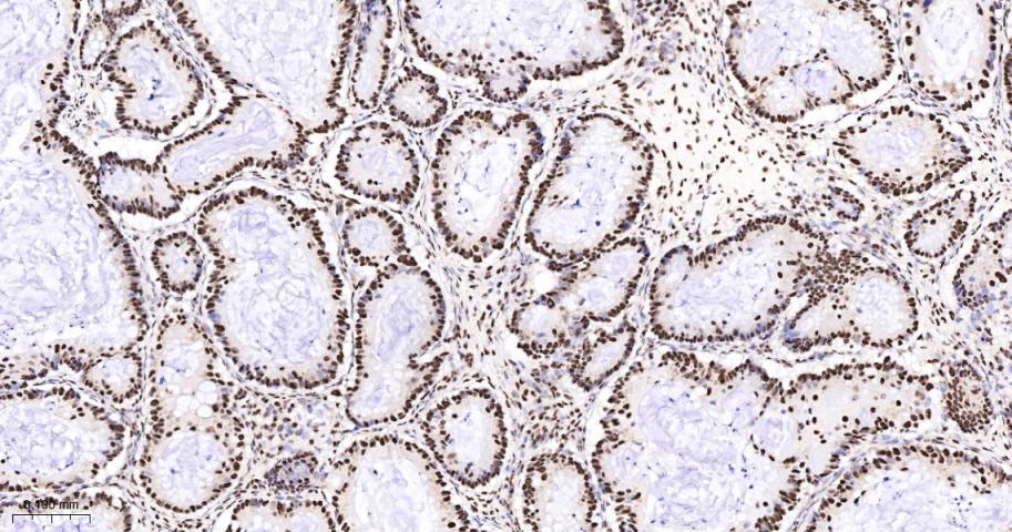 转录中介因子Tif1β重组兔单抗