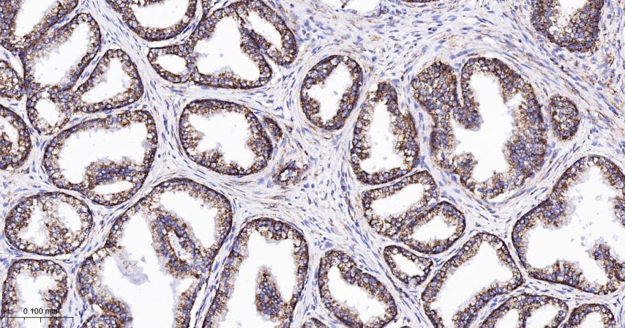 TSPO蛋白重组兔单抗