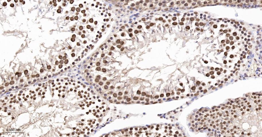 转录中介因子Tif1β重组兔单抗