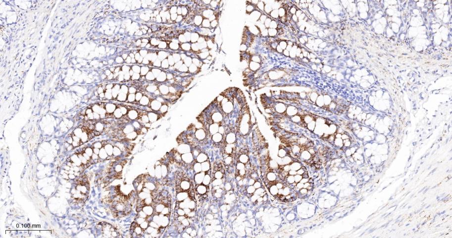 三羟基三甲基辅酶A合成酶2重组兔单抗