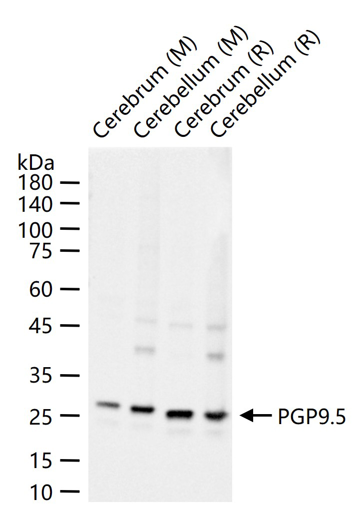 神经细胞胞浆蛋白9.5重组兔单抗