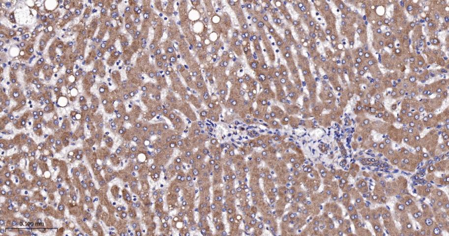 脂肪酸去饱和酶1重组兔单抗