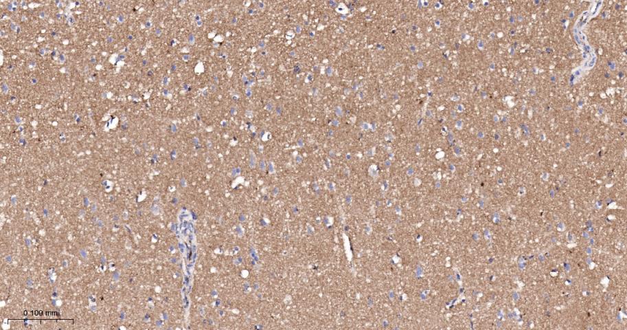 脂阀结构蛋白1重组兔单抗