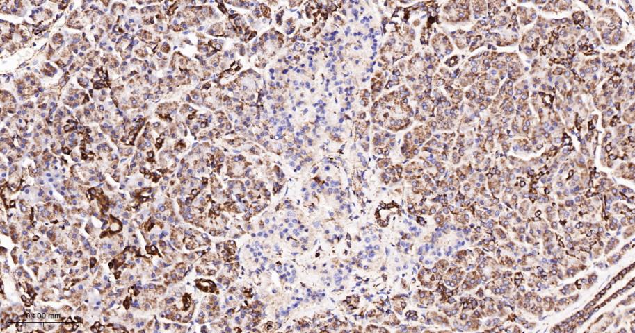 TSPO蛋白重组兔单抗