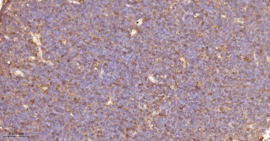 转录因子RelB蛋白重组兔单抗