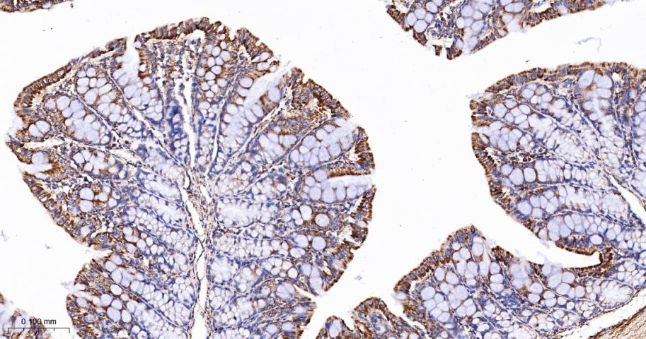 TSPO蛋白重组兔单抗