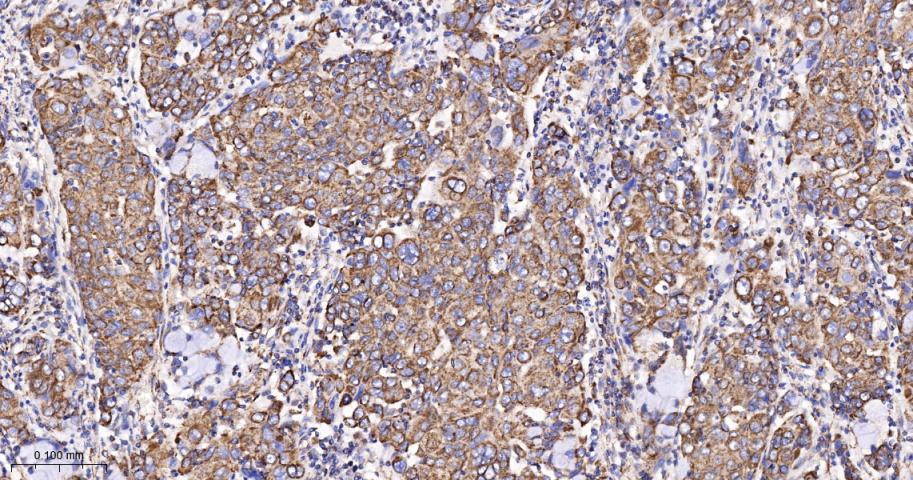 TSPO蛋白重组兔单抗