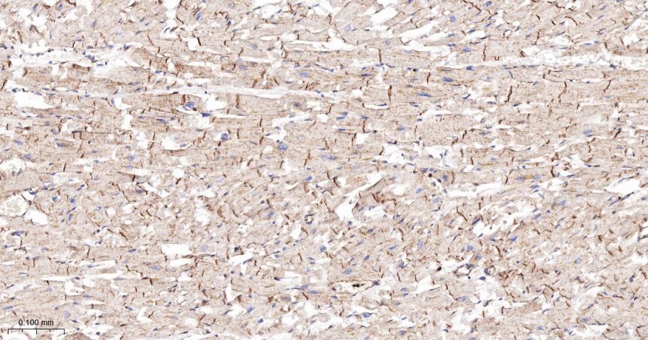 脂阀结构蛋白1重组兔单抗