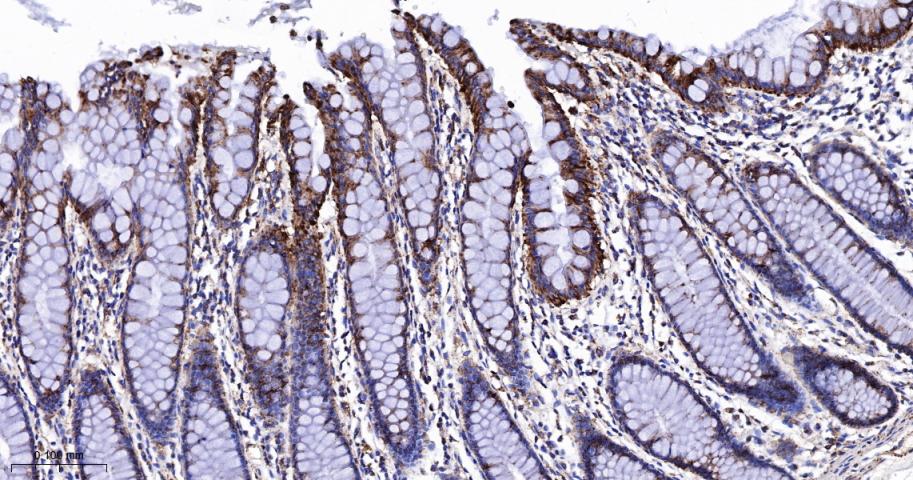 TSPO蛋白重组兔单抗