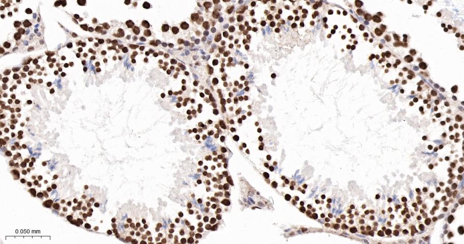 转录中介因子Tif1β重组兔单抗
