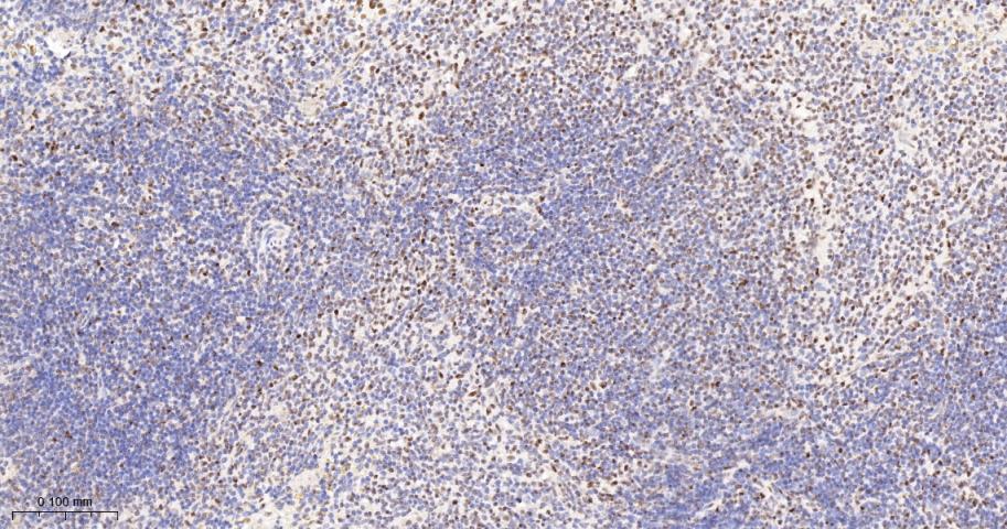 转录中介因子Tif1β重组兔单抗