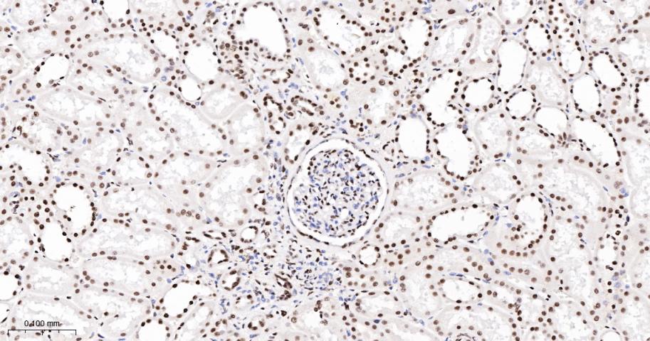 转录中介因子Tif1β重组兔单抗