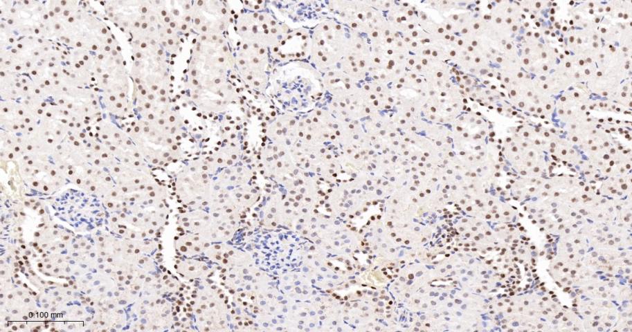转录中介因子Tif1β重组兔单抗