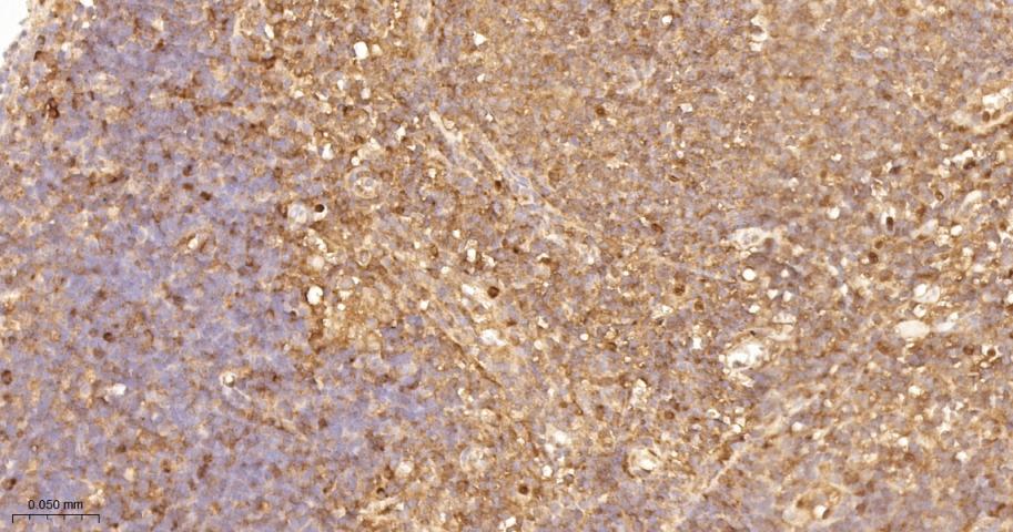 转录因子RelB蛋白重组兔单抗