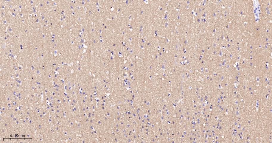 突触相关蛋白25重组兔单抗