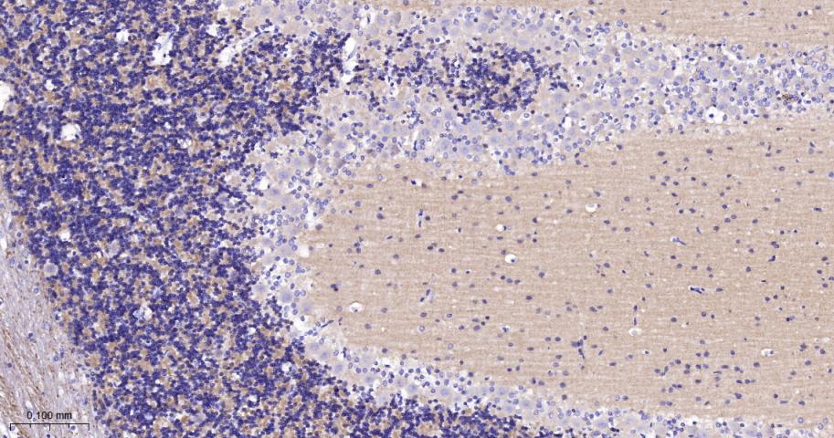 突触相关蛋白25重组兔单抗