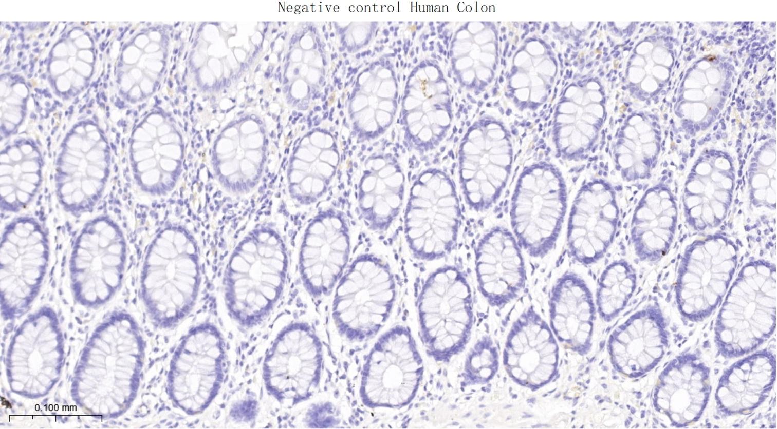 突触相关蛋白25重组兔单抗