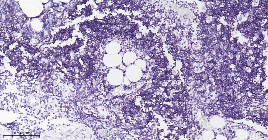 末端脱氧核苷酸转移酶重组兔单抗-bsm-61808R