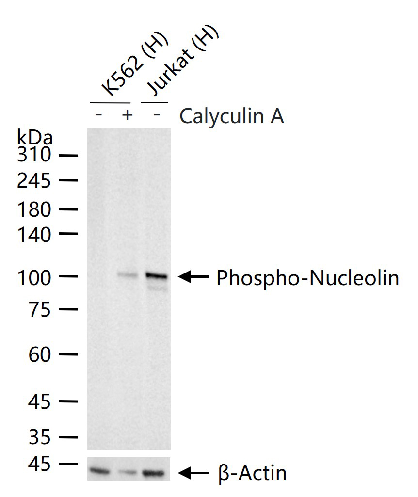 phospho-Nucleolin (Thr84) Recombinant Rabbit mAb (一抗) - WB,IHC-P,IHC-F,IF | Bioss