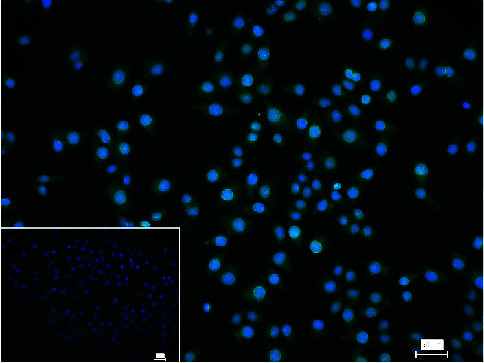 核纤层蛋白A重组兔单抗