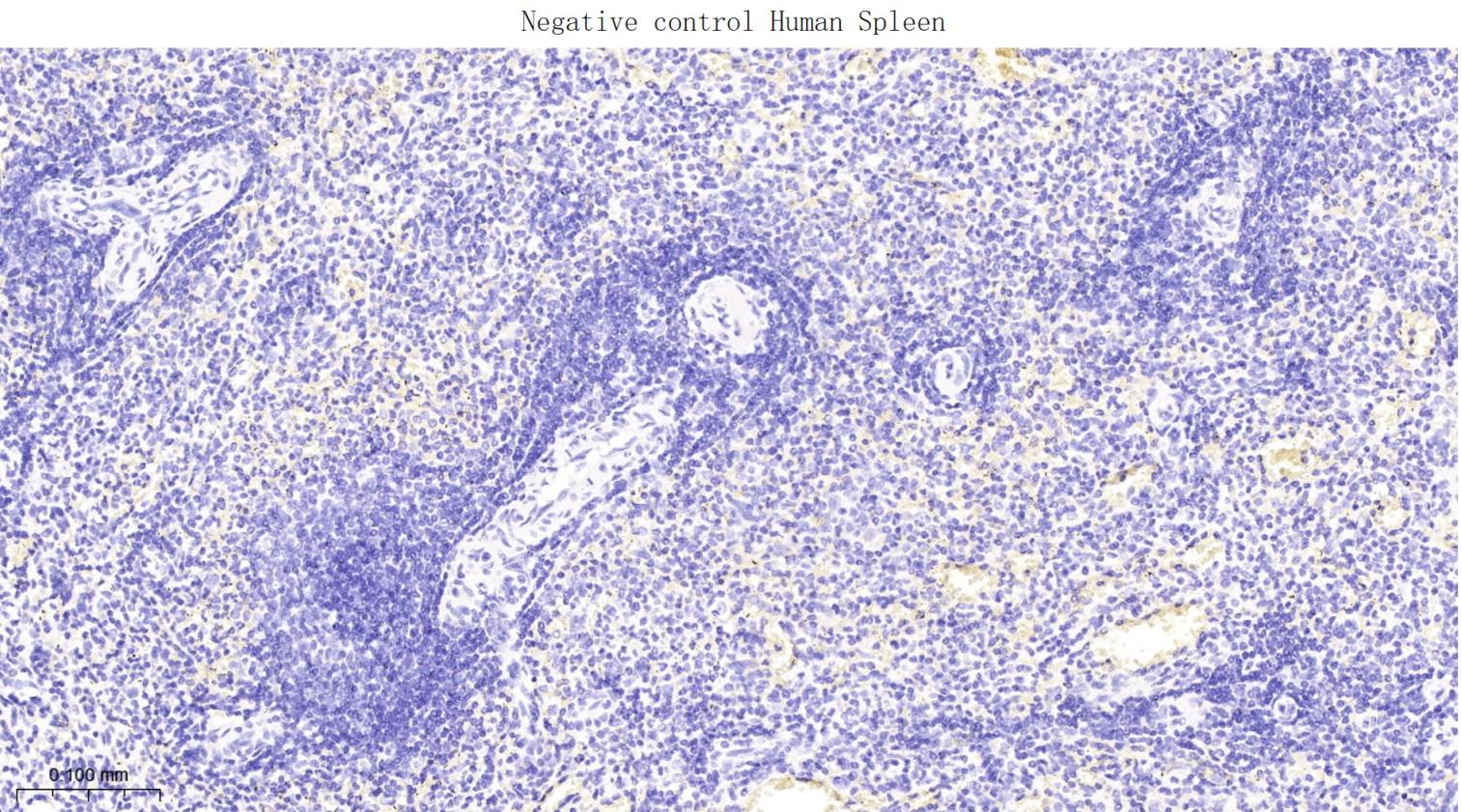 突触相关蛋白25重组兔单抗