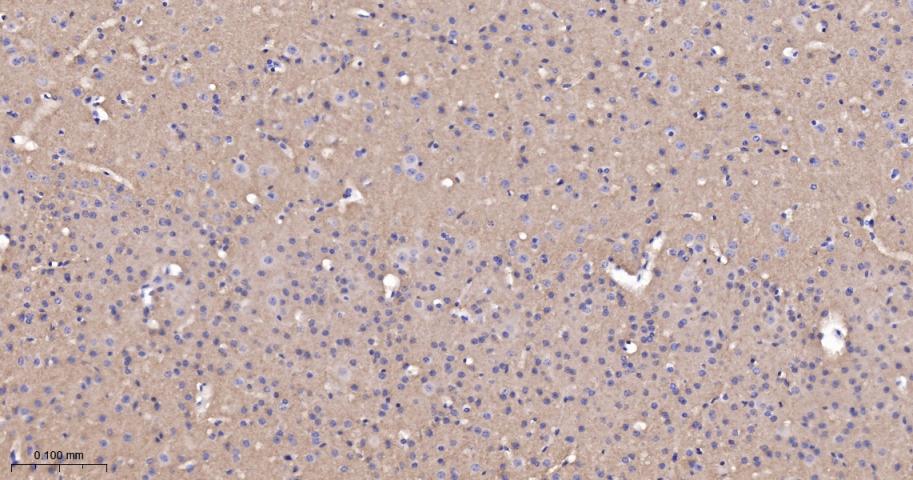 突触相关蛋白25重组兔单抗
