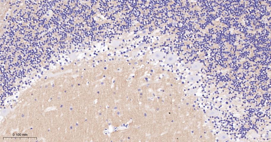 突触相关蛋白25重组兔单抗