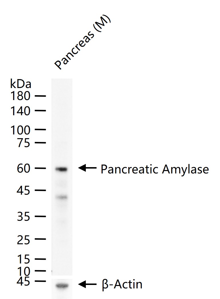 AMY2A Rabbit pAb (一抗) - WB,IHC-P,IHC-F,IF | Bioss