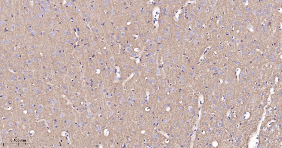 突触相关蛋白25重组兔单抗