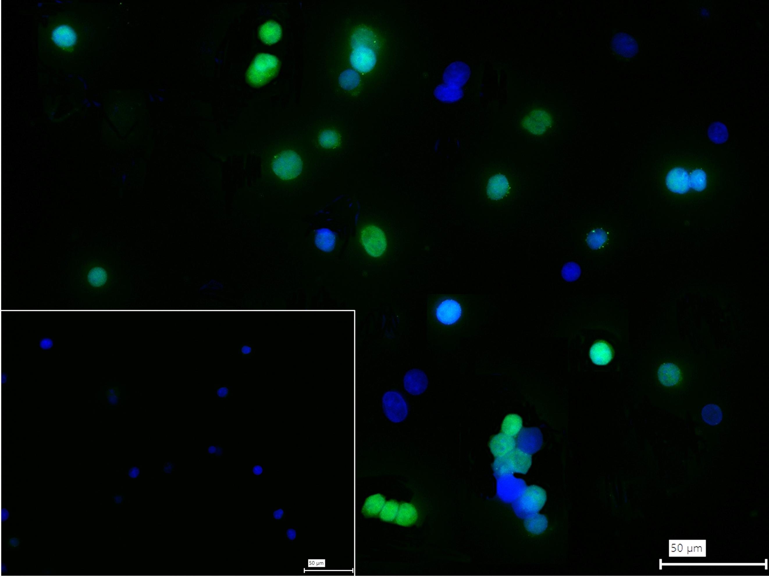 转录因子E2F-4重组兔单抗