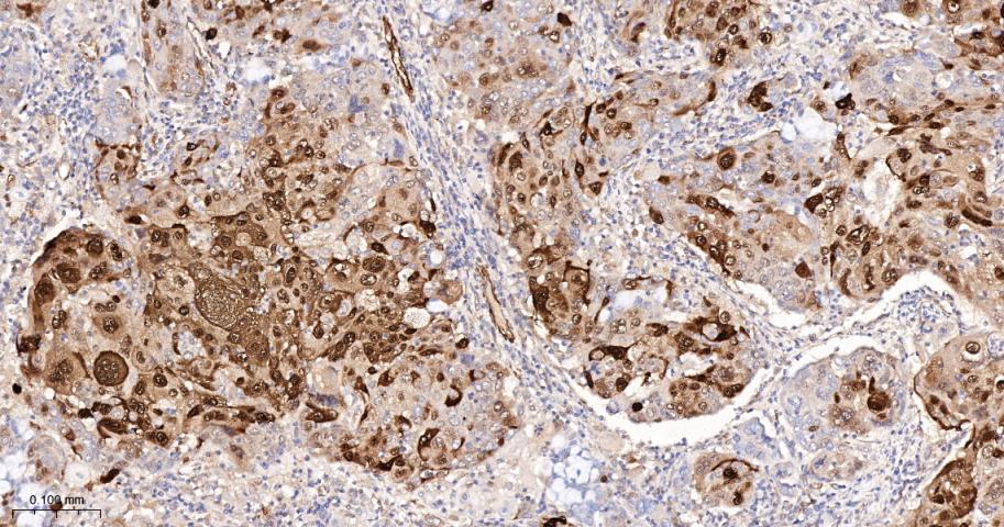 磷酸化热休克蛋白27重组兔单抗-bsm-52167R