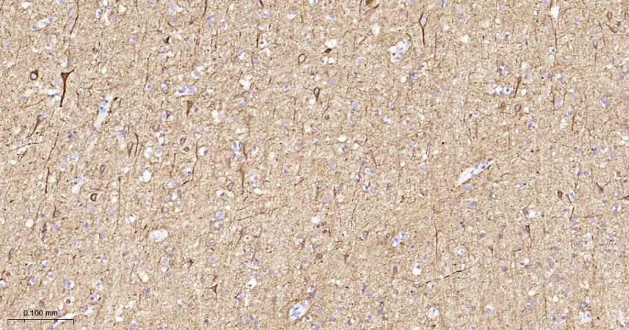 低分子量神经丝蛋白重组兔单抗
