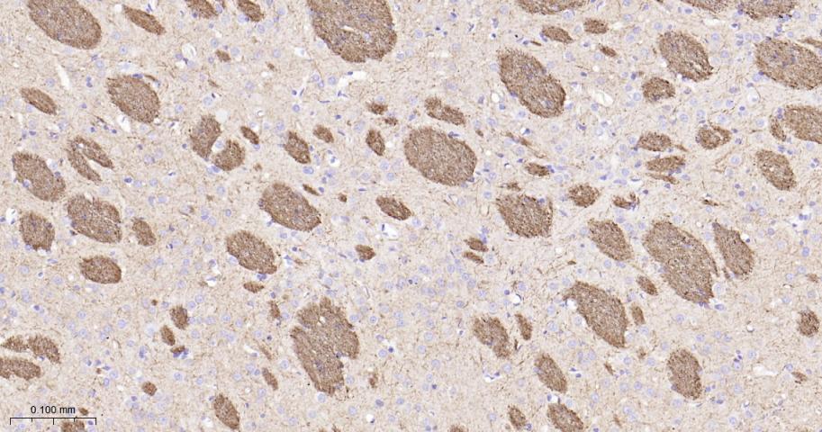 低分子量神经丝蛋白重组兔单抗