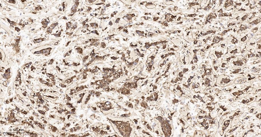 磷酸化热休克蛋白27重组兔单抗-bsm-52167R