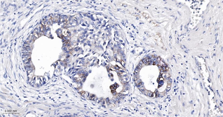 活化白细胞粘附分子重组兔单抗