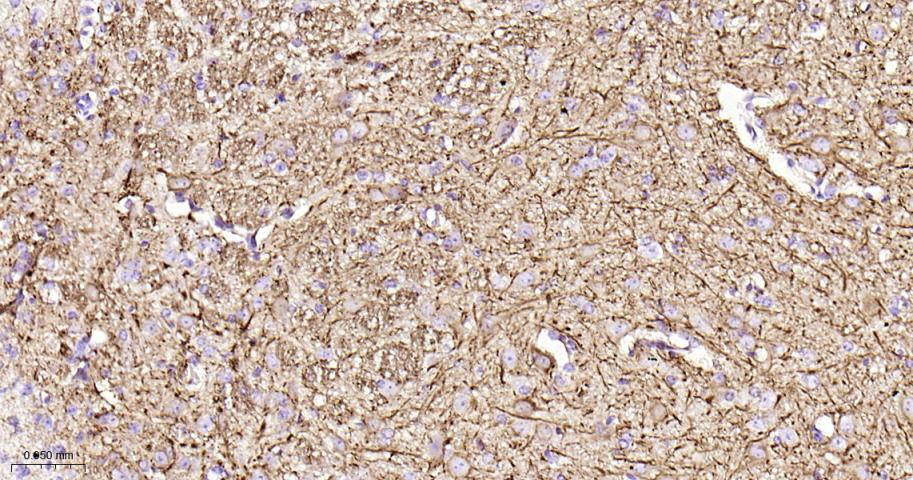 低分子量神经丝蛋白重组兔单抗