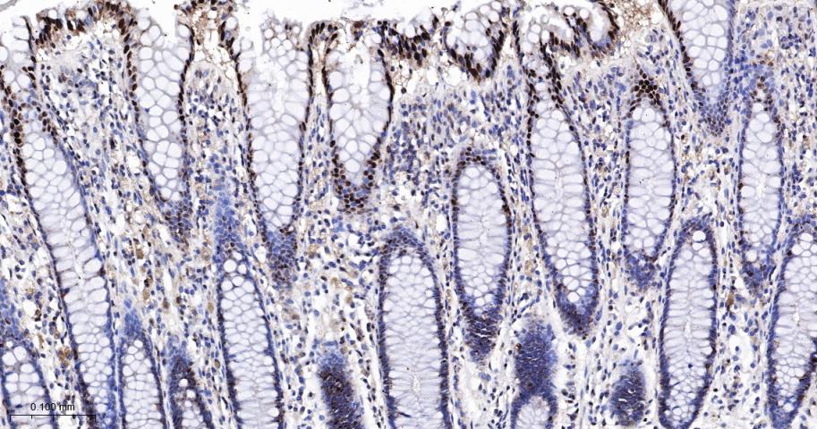 凋亡相关蛋白4重组兔单抗