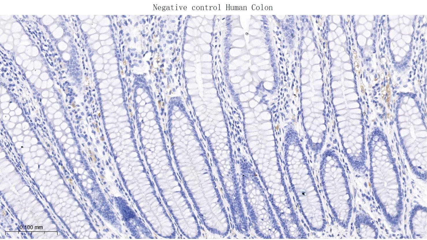 细胞角蛋白5重组兔单抗