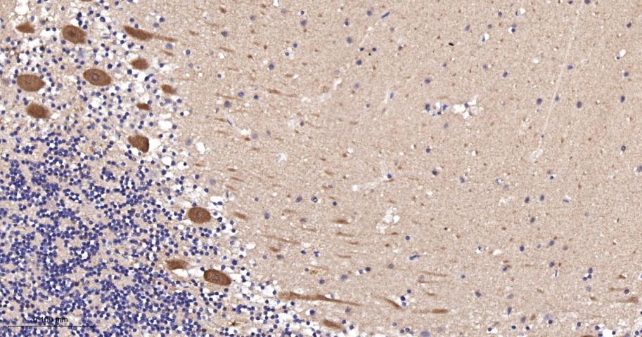 β-抑制蛋白1重组兔单抗-bsm-61185R