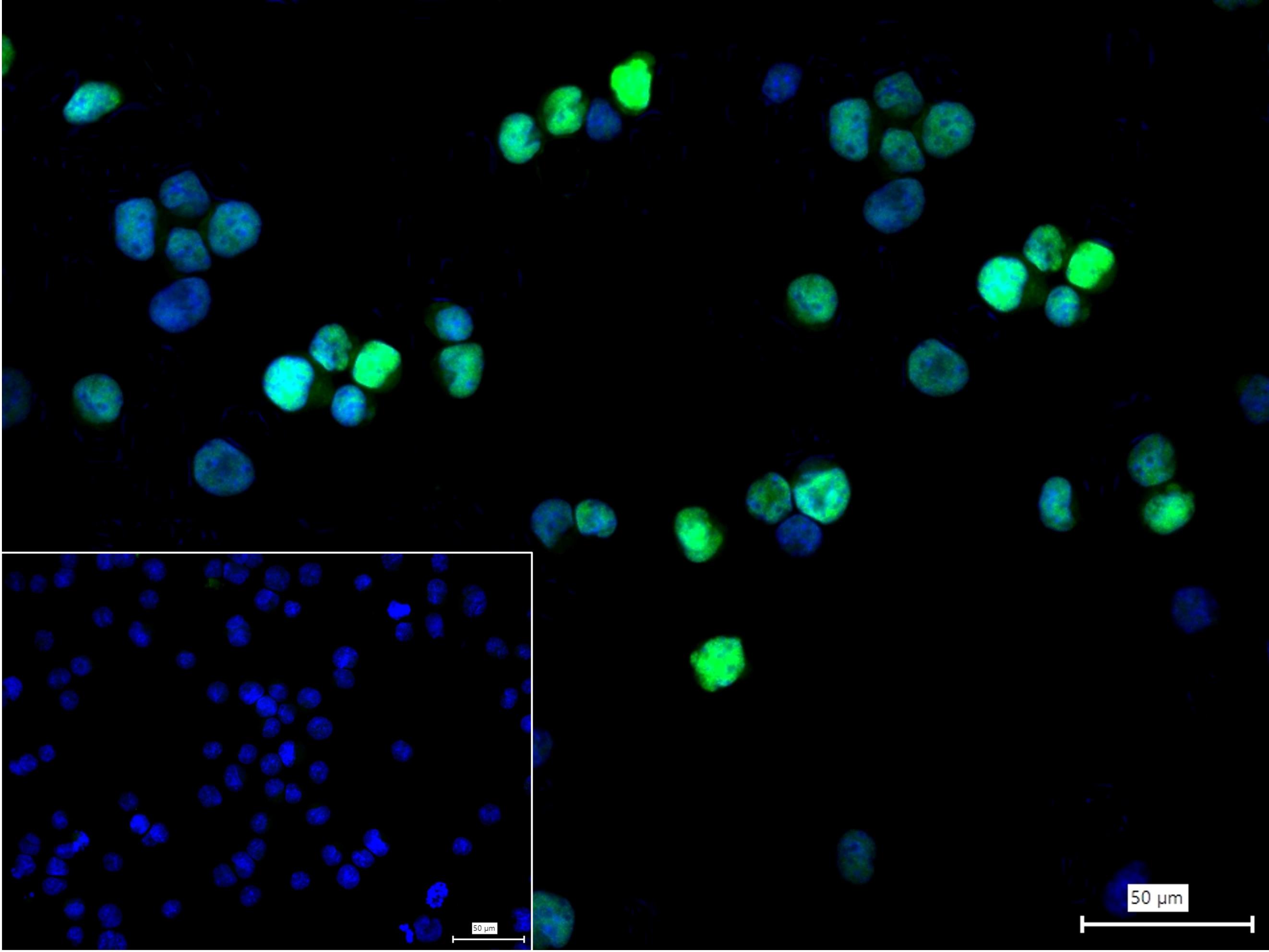 干扰素调节因子4重组兔单抗