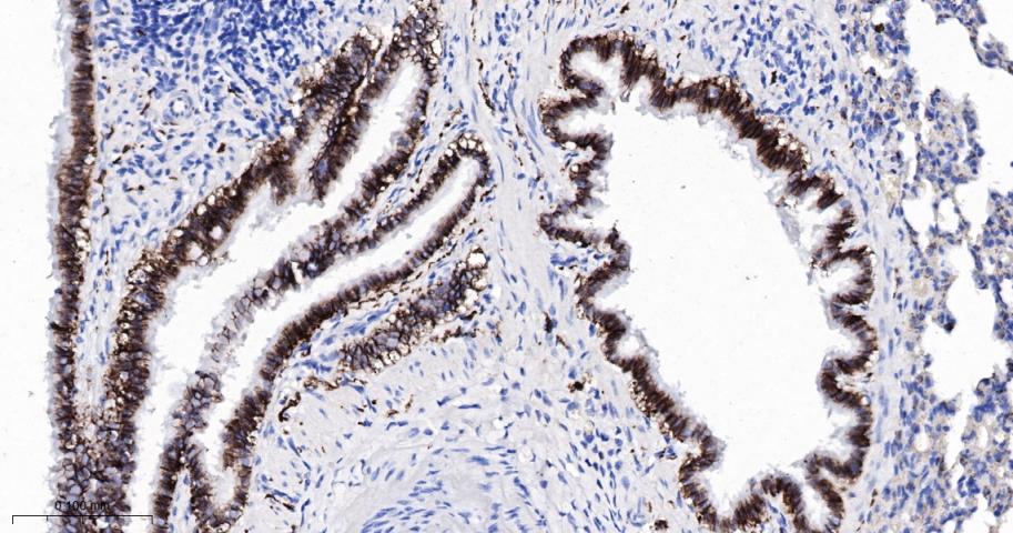 活化白细胞粘附分子重组兔单抗