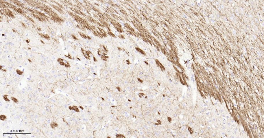 低分子量神经丝蛋白重组兔单抗