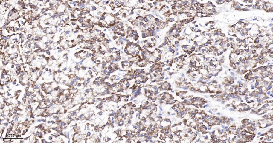 凋亡相关蛋白4重组兔单抗