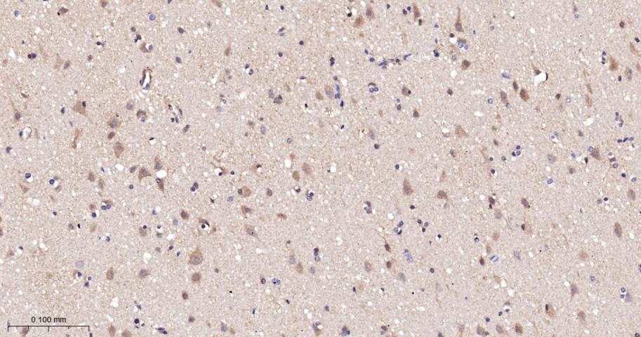 β-抑制蛋白1重组兔单抗-bsm-61185R