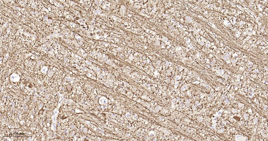低分子量神经丝蛋白重组兔单抗