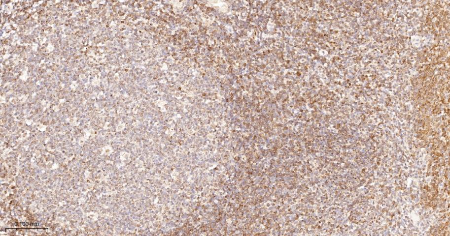 凋亡相关蛋白4重组兔单抗