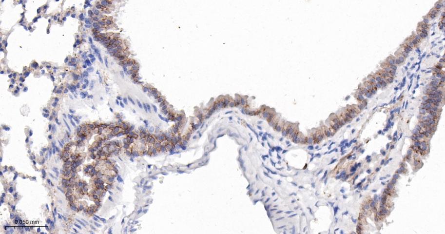 活化白细胞粘附分子重组兔单抗
