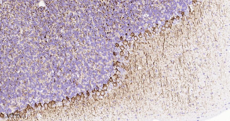 低分子量神经丝蛋白重组兔单抗